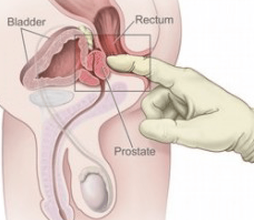 Lingam Male Prostate Massage Tantric Journey - 